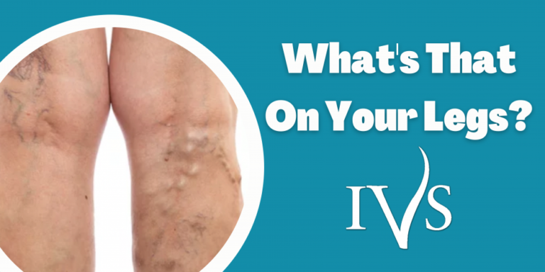 What’s That On Your Legs?