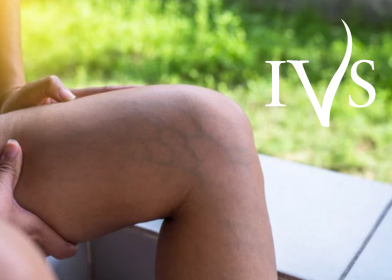 How Does Injury Impact Your Veins?